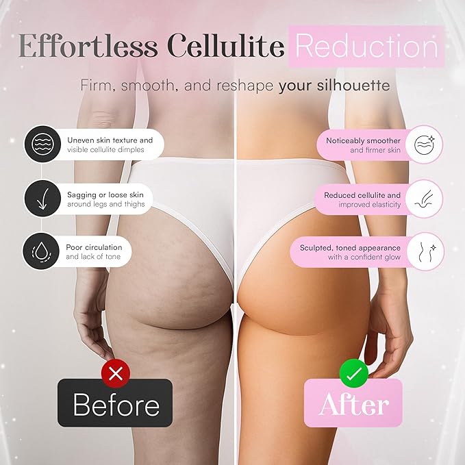 3-in-1 Body Sculpting Machine – Thermoslim Cellulite Massager with Cupping & Red Light Therapy for Belly, Skin, Back, Waist, Legs & Arm Tightening Device